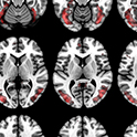 brain imagery